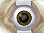 By now, the pupil will be fully open, or dilated.