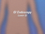 Lower GI endoscopy only rarely leads to complications.