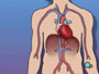 A rare complication of a cardiac catheterization is a stroke. 
<p> But cardiac catheterization is one of the least invasive and least risky of all cardiac procedures. </p>