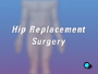 You doctor has recommended that you undergo hip replacement surgery. But what exactly does that mean?