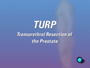 TURP is considered to be a simple surgical procedure. However, there are some alternatives.