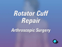 Rotator cuff surgery only rarely leads to complications.
