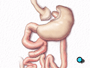The other free end of the intestine is surgically stitched to the side of an intestinal loop.