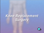 Knee replacement surgery rarely leads to complications.